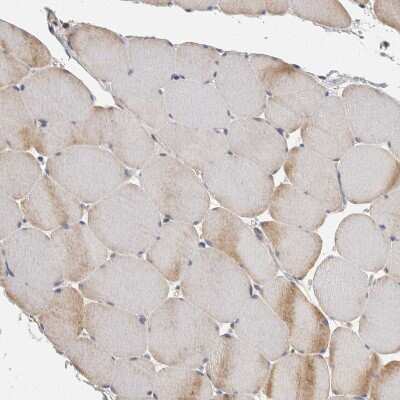 Immunohistochemistry-Paraffin: ACAT2 Antibody [NBP1-89525]
