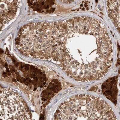 Immunohistochemistry-Paraffin: ACAT2 Antibody [NBP1-89525]