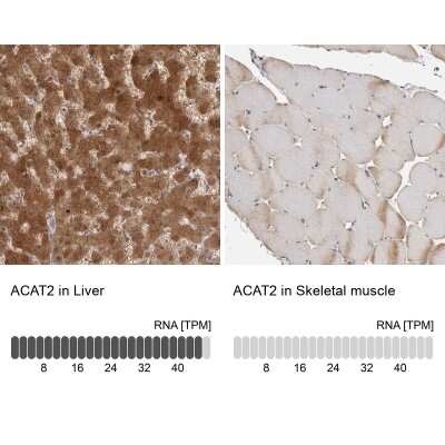 Immunohistochemistry-Paraffin: ACAT2 Antibody [NBP1-89525]