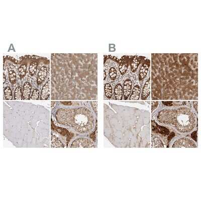 Immunohistochemistry-Paraffin: ACAT2 Antibody [NBP1-89526]