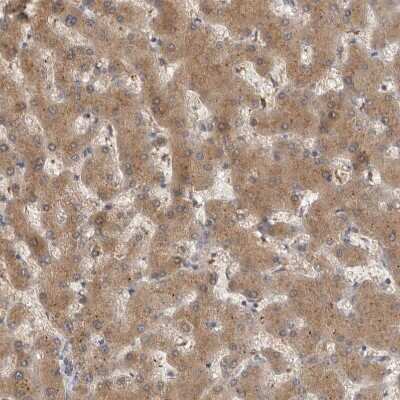 Immunohistochemistry-Paraffin: ACAT2 Antibody [NBP1-89526]