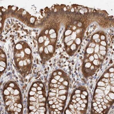 Immunohistochemistry-Paraffin: ACAT2 Antibody [NBP1-89526]