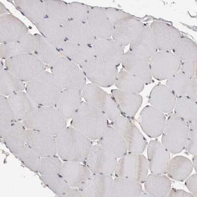 Immunohistochemistry-Paraffin: ACAT2 Antibody [NBP1-89526]