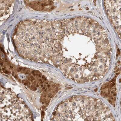 Immunohistochemistry-Paraffin: ACAT2 Antibody [NBP1-89526]