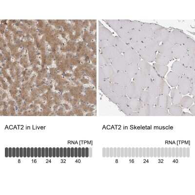 Immunohistochemistry-Paraffin: ACAT2 Antibody [NBP1-89526]