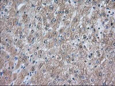 Immunohistochemistry: ACAT2 Antibody (OTI3E2) - Azide and BSA Free [NBP2-70068]
