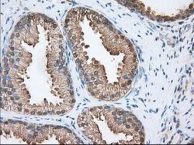 Immunohistochemistry: ACAT2 Antibody (OTI3E2) - Azide and BSA Free [NBP2-70068]
