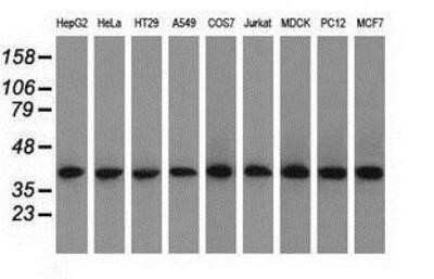 Western Blot: ACAT2 Antibody (OTI3E2)Azide and BSA Free [NBP2-70068]
