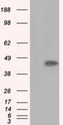 Western Blot: ACAT2 Antibody (OTI3E2)Azide and BSA Free [NBP2-70068]