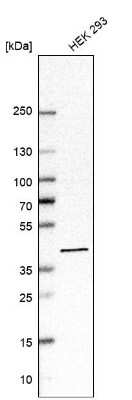 Western Blot: ACAT2 Antibody [NBP1-85967]