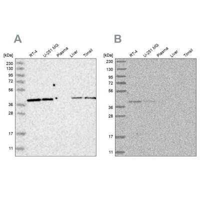 Western Blot: ACAT2 Antibody [NBP1-89525]