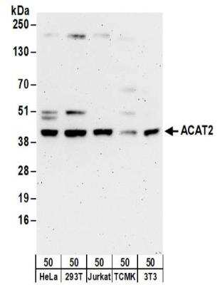 Western Blot: ACAT2 Antibody [NBP2-32198]