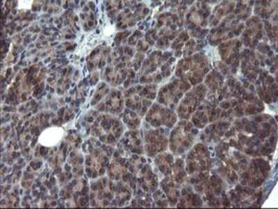Immunohistochemistry: ACBD3 Antibody (OTI1G2) [NBP2-46478]