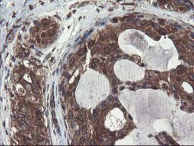 Immunohistochemistry: ACBD3 Antibody (OTI1G2) [NBP2-46478]