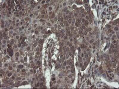 Immunohistochemistry: ACBD3 Antibody (OTI1G2) [NBP2-46478]