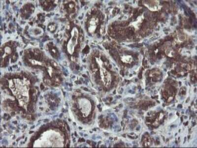 Immunohistochemistry: ACBD3 Antibody (OTI1G2) [NBP2-46478]