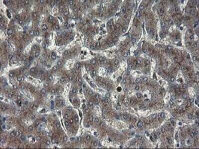 Immunohistochemistry: ACBD3 Antibody (OTI1G2) [NBP2-46478]