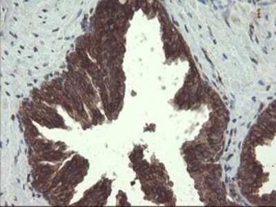 Immunohistochemistry: ACBD3 Antibody (OTI1G2) [NBP2-46478]