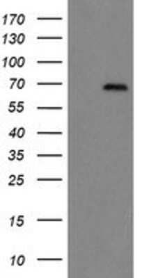 Western Blot: ACBD3 Antibody (OTI3A1) [NBP2-03720]