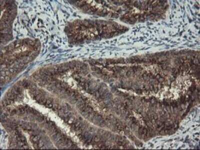 Immunohistochemistry: ACBD3 Antibody (OTI1G2) - Azide and BSA Free [NBP2-72148]