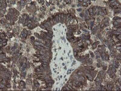 Immunohistochemistry: ACBD3 Antibody (OTI1G2) - Azide and BSA Free [NBP2-72148]