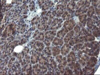 Immunohistochemistry: ACBD3 Antibody (OTI1G2) - Azide and BSA Free [NBP2-72148]