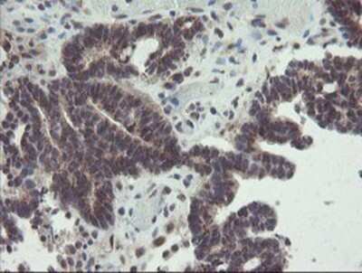 Immunohistochemistry: ACBD3 Antibody (OTI3A1) - Azide and BSA Free [NBP2-72149]