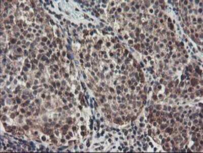 Immunohistochemistry: ACBD3 Antibody (OTI3A1) - Azide and BSA Free [NBP2-72149]