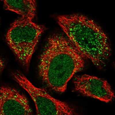 Immunocytochemistry/ Immunofluorescence: ACBD4 Antibody [NBP2-14258]