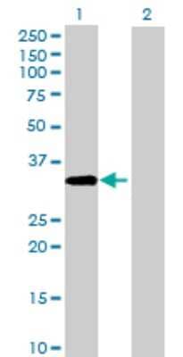 Western Blot: ACBD4 Antibody [H00079777-B01P]