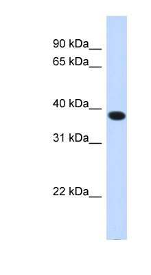 Western Blot: ACBD4 Antibody [NBP1-59995]