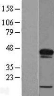 Western Blot: ACBD4 Overexpression Lysate [NBL1-07227]