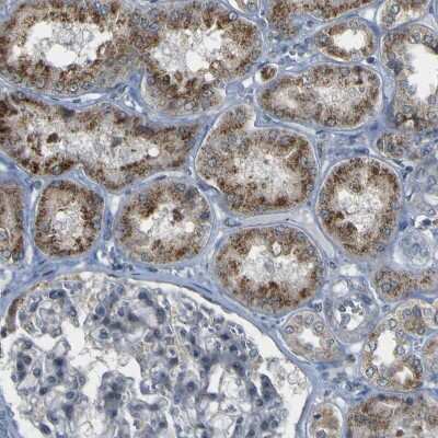 Immunohistochemistry-Paraffin: ACBD5 Antibody [NBP1-85145]