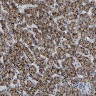 Immunohistochemistry-Paraffin: ACBD5 Antibody [NBP1-85145]
