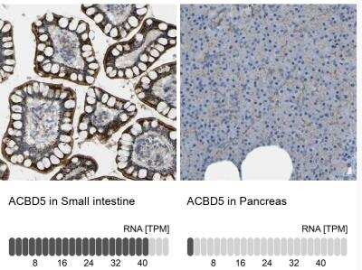 Immunohistochemistry-Paraffin: ACBD5 Antibody [NBP1-85146]