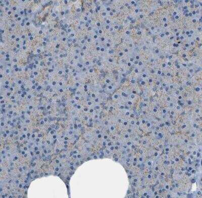 Immunohistochemistry-Paraffin: ACBD5 Antibody [NBP1-85146]