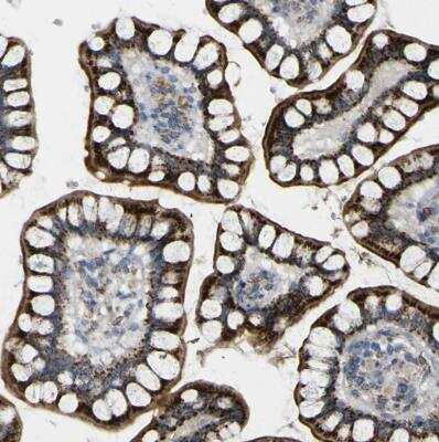 Immunohistochemistry-Paraffin: ACBD5 Antibody [NBP1-85146]
