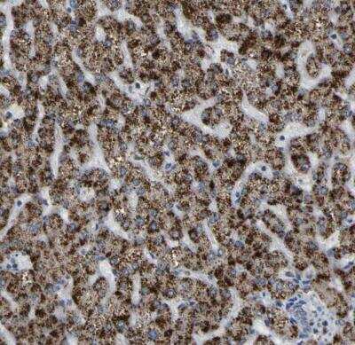 Immunohistochemistry-Paraffin: ACBD5 Antibody [NBP1-85146]