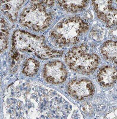 Immunohistochemistry-Paraffin: ACBD5 Antibody [NBP1-85146]