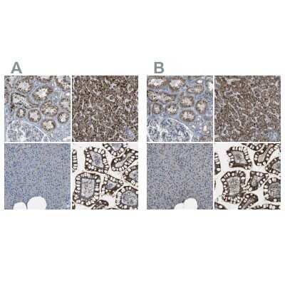 Immunohistochemistry-Paraffin: ACBD5 Antibody [NBP1-85146]