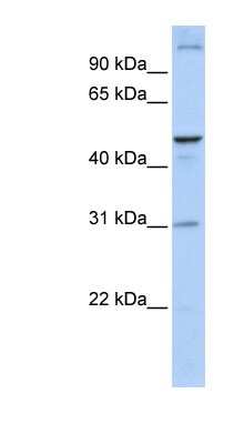 Western Blot: ACBD5 Antibody [NBP1-59820]