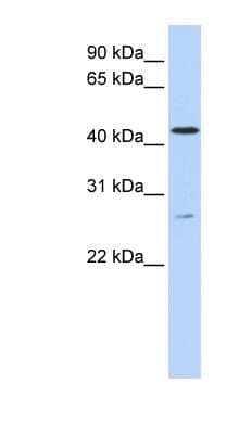 Western Blot: ACBD5 Antibody [NBP1-59821]