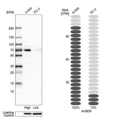 Western Blot: ACBD5 Antibody [NBP1-85145]