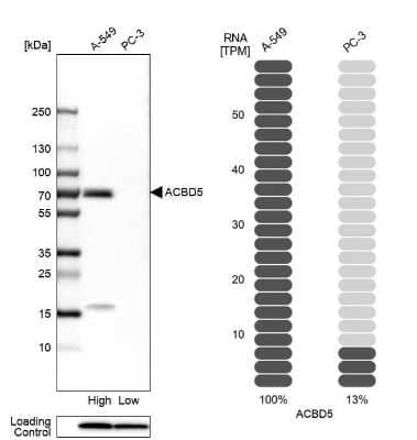 Western Blot: ACBD5 Antibody [NBP1-85146]