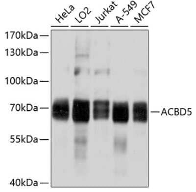 Western Blot: ACBD5 AntibodyBSA Free [NBP2-92034]