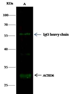 Immunoprecipitation: ACBD6 Antibody (4A9D5E9) [NBP3-06614]