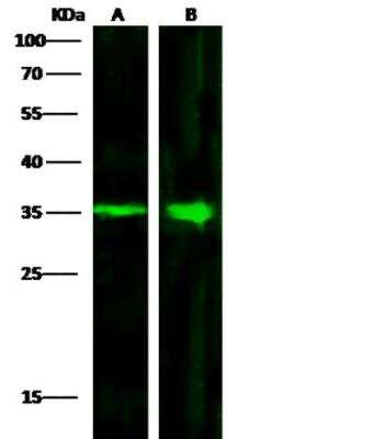 Western Blot: ACBD6 Antibody (4A9D5E9) [NBP3-06614]