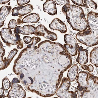 Immunohistochemistry-Paraffin: ACBD6 Antibody [NBP1-81158]