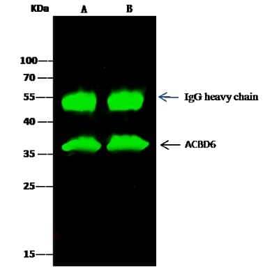 Immunoprecipitation: ACBD6 Antibody [NBP2-99708]