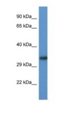 Western Blot: ACBD6 Antibody [NBP1-79817]